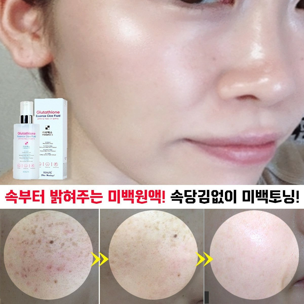 Made in Korea Glutathione Essence Cica Fluid melasma-x Skin soothing moisturizing essence that melts the freckles (1+1+1)(free shipping)